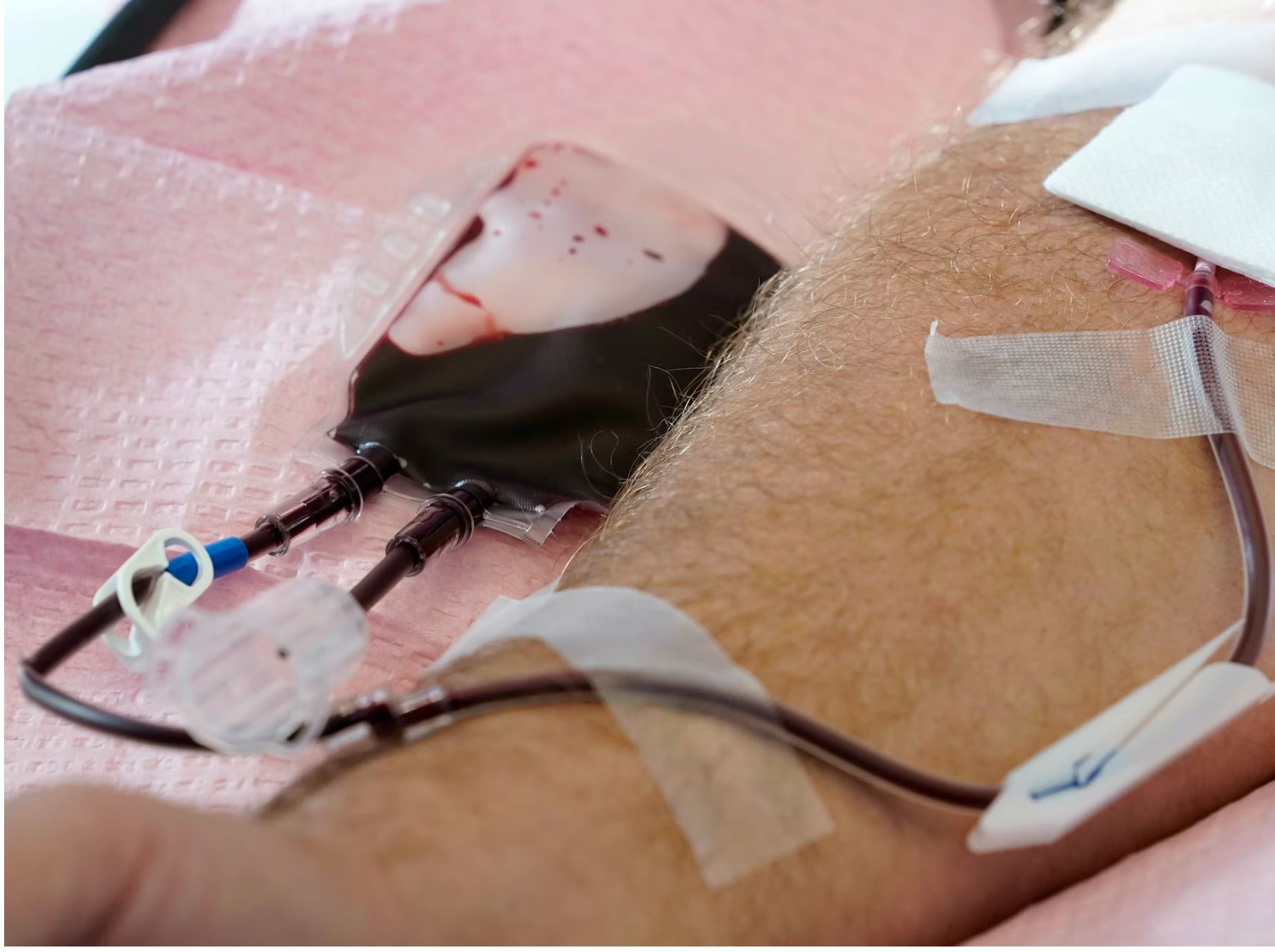 The U.S. is moving to ease restrictions on blood donations from gay and bisexual men and other groups that traditionally face higher risks of HIV.